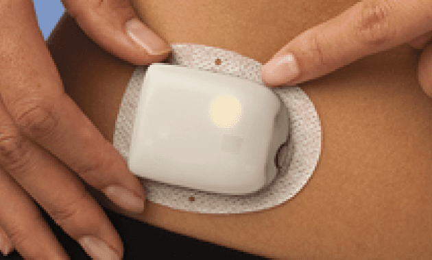 OMNIPOD 5 SNAP-ON COVER 💜
Protect • Personalise • Love Your Pod